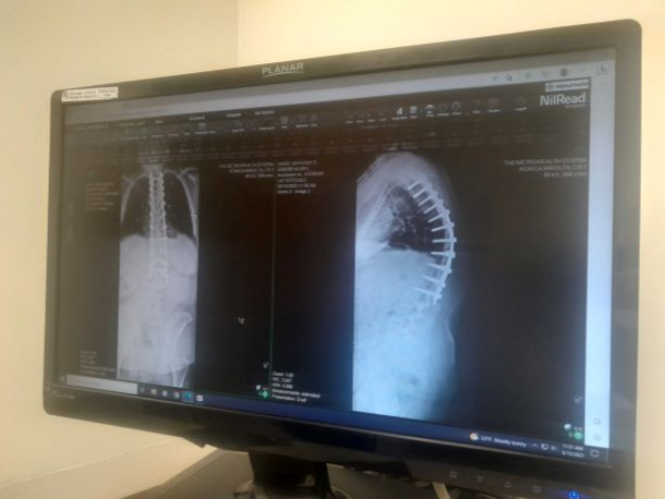 A photo from Tony Ward’s hospital stay during recovery from major spine surgery